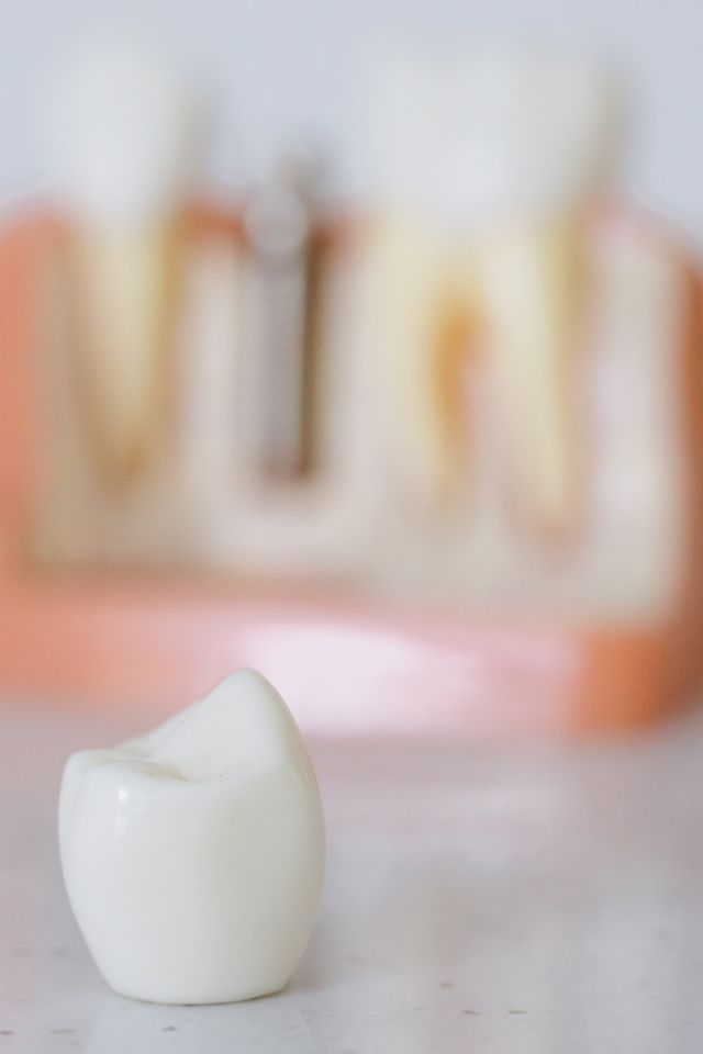 Rehabilitación oral